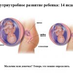 Срок беременности 14 недель