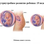 Срок беременности 19 недель