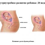 Срок беременности 20 недель