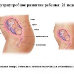 Срок беременности 21 неделя