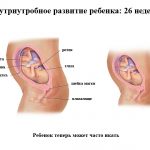 Срок беременности 26 недель