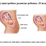Срок беременности 29 недель