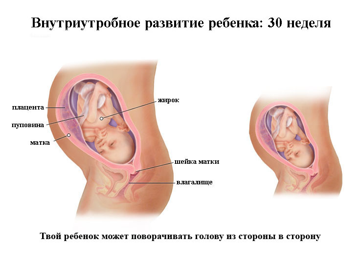 Срок беременности 30 недель