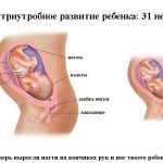 Срок беременности 31 неделя