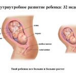 Срок беременности 32 недели