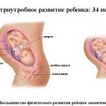 Срок беременности 34 недели