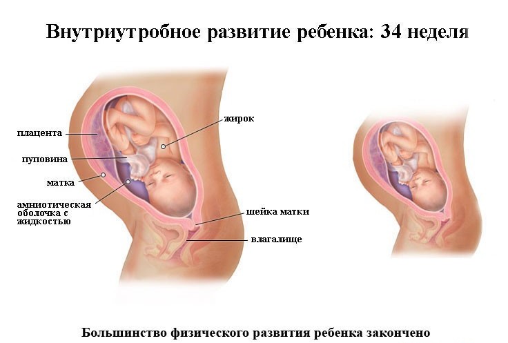 Срок беременности 34 недели