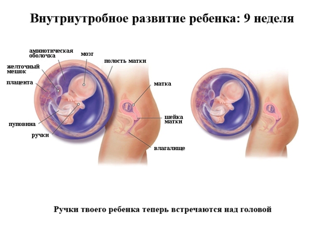 Срок беременности 9 недель